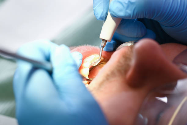 Best Broken or Chipped Tooth Repair in Penhook, VA