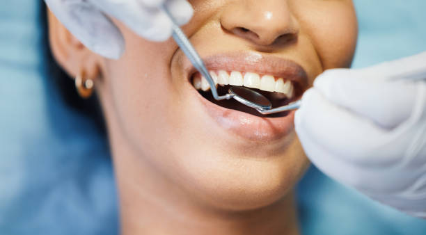 Best Knocked-Out Tooth (Avulsed Tooth) Treatment in Penhook, VA
